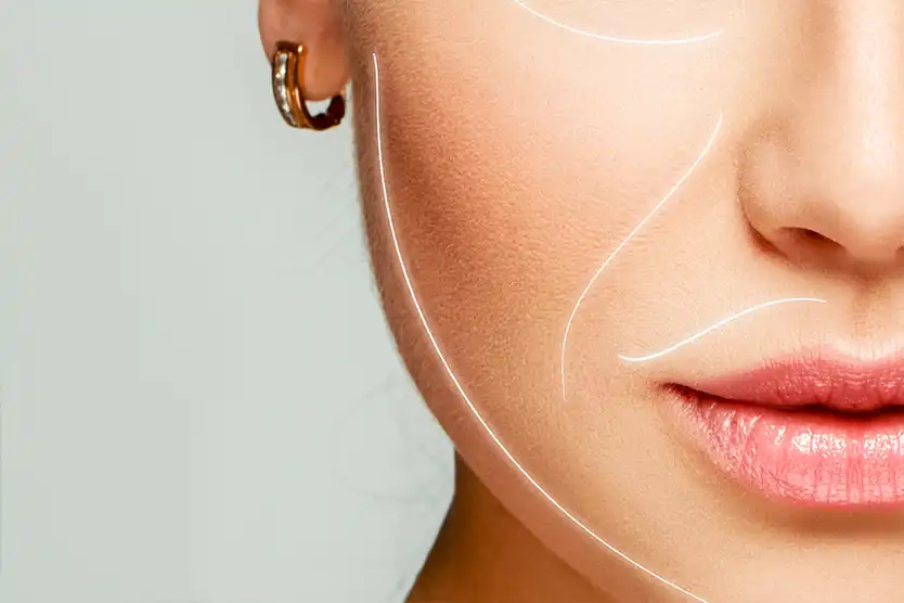 Preenchimento de Bigode Chinês com Especialista