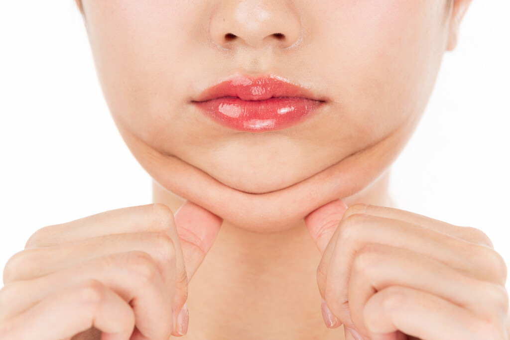 Gordura submentoniana: o que é, por que aparece e como ela afeta o contorno facial